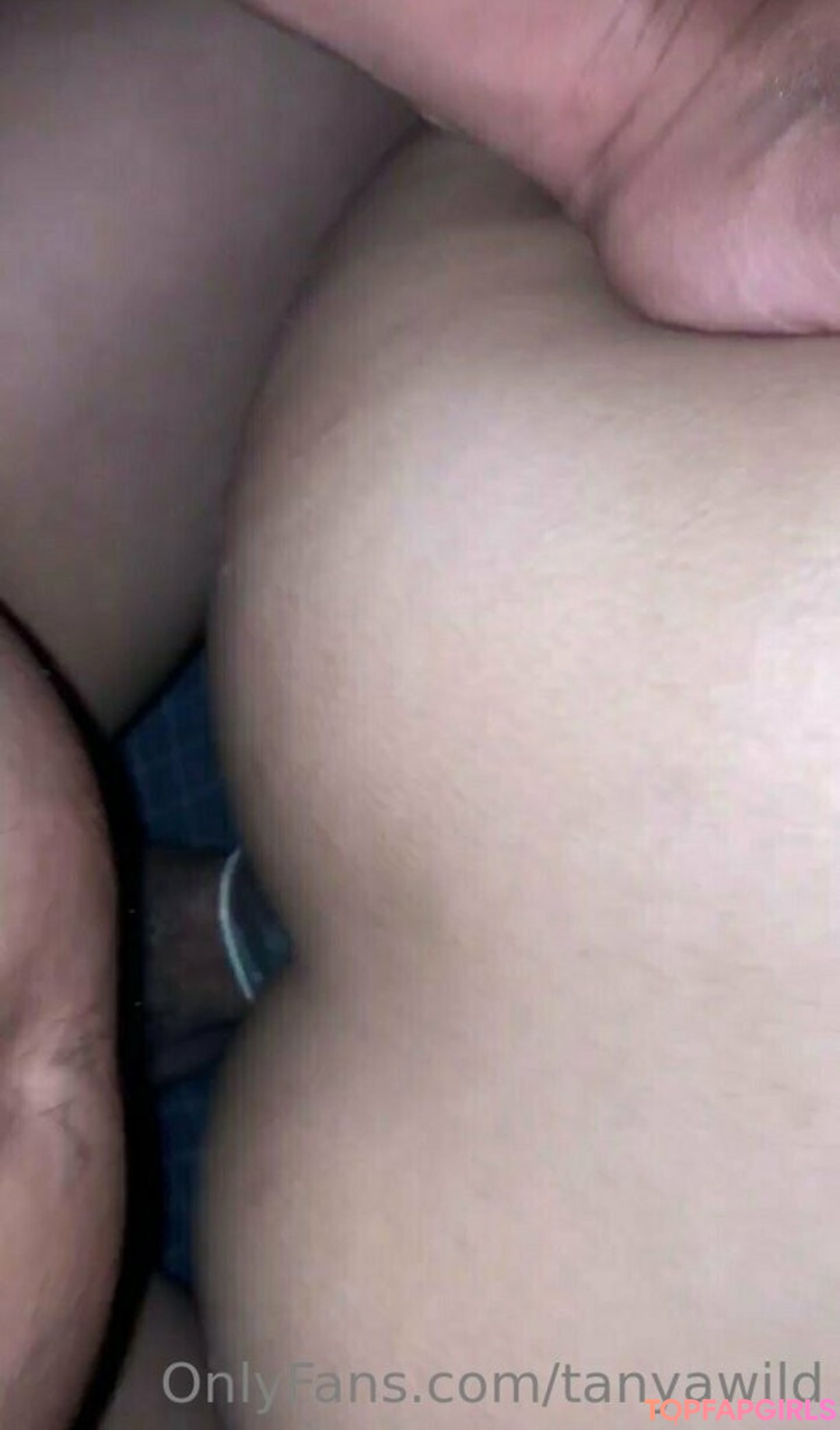 braces onlyfans sexy nude pic