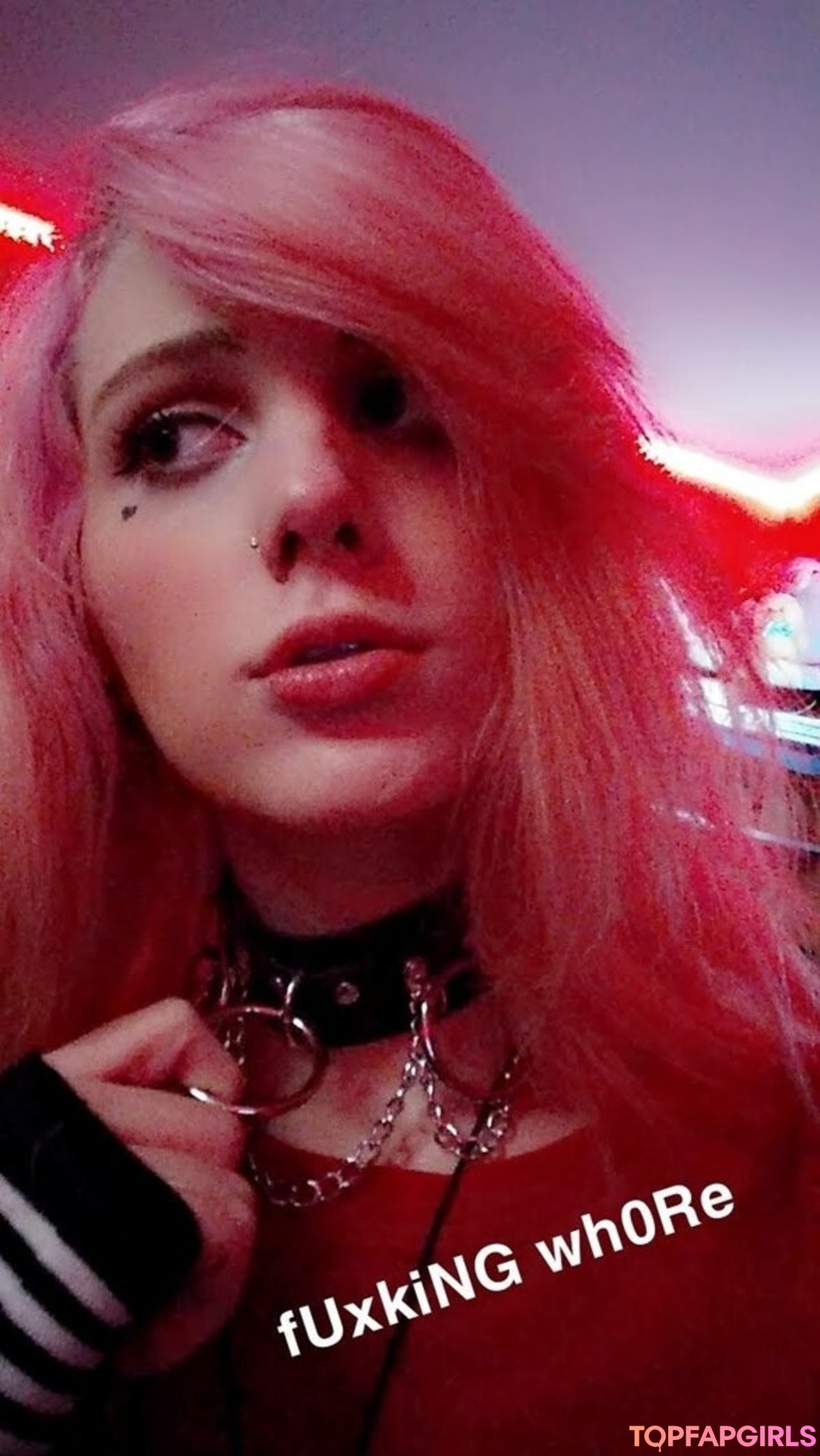 braces onlyfans adult gallery