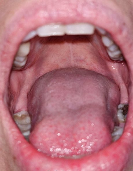 jackdaspeck star naked pics