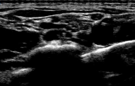 kacenna model nudes photo