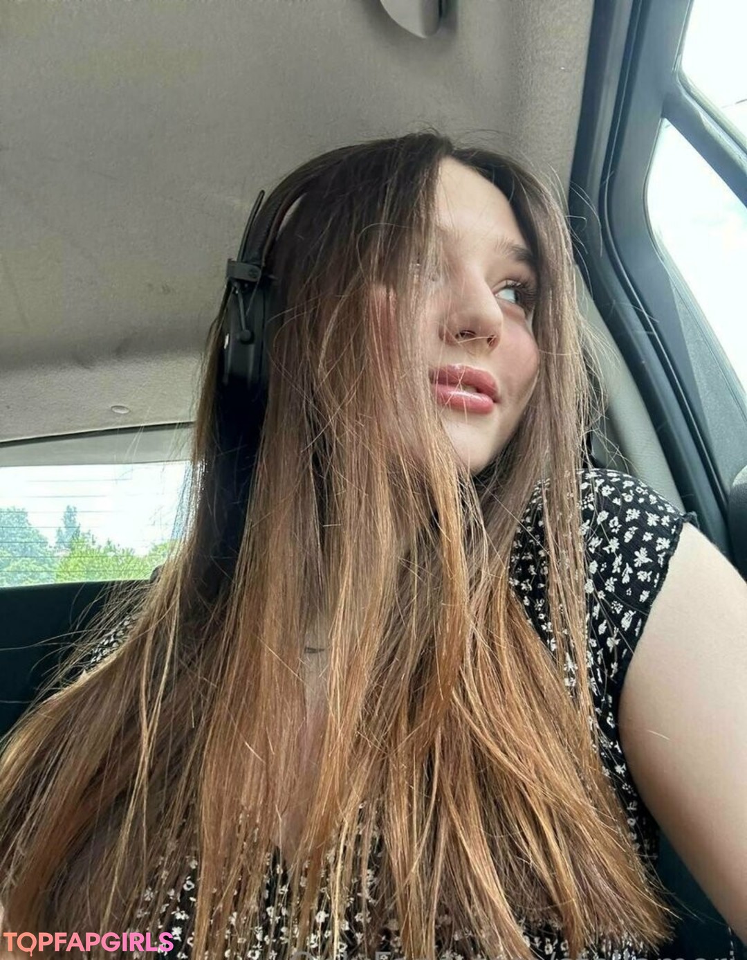 braces onlyfans pretty gallery