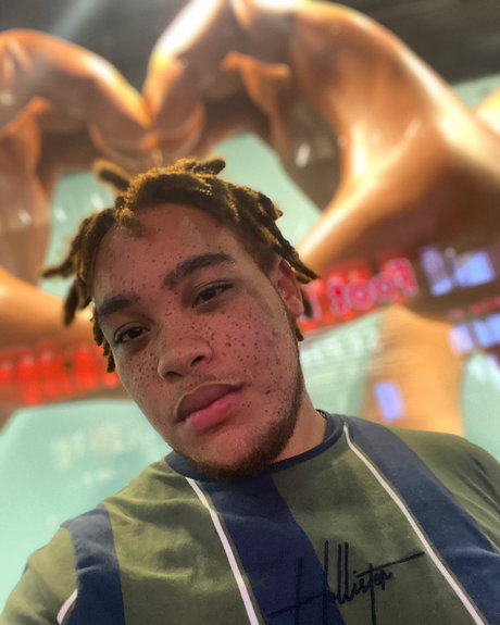 Freckles star nice photo