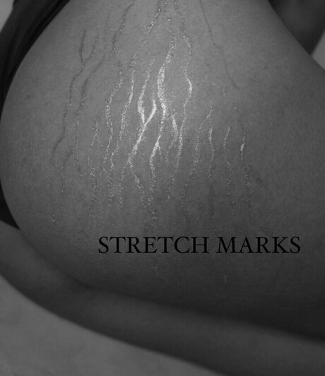 bunny nurse onlyfans art naked picture