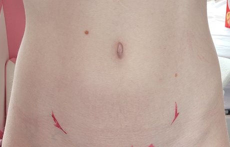 asshole onlyfans top photos