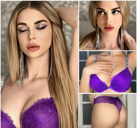 local onlyfans top image