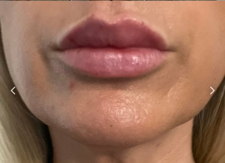 naked milf onlyfans hot pic