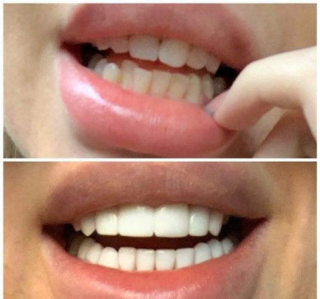 famous nude onlyfans free sex galleries