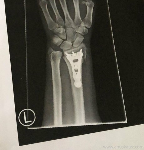 Anuskatzz model sexy pictures