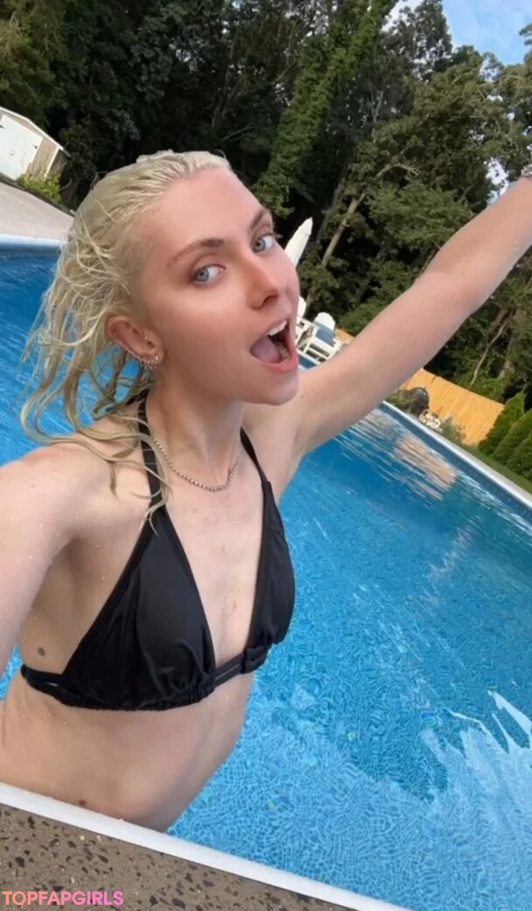 braces onlyfans sexy galleries
