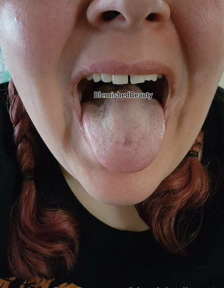 blemishedbeauty hd actress gallery