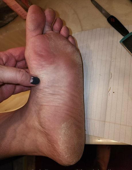 blemishedbeauty model best gallery