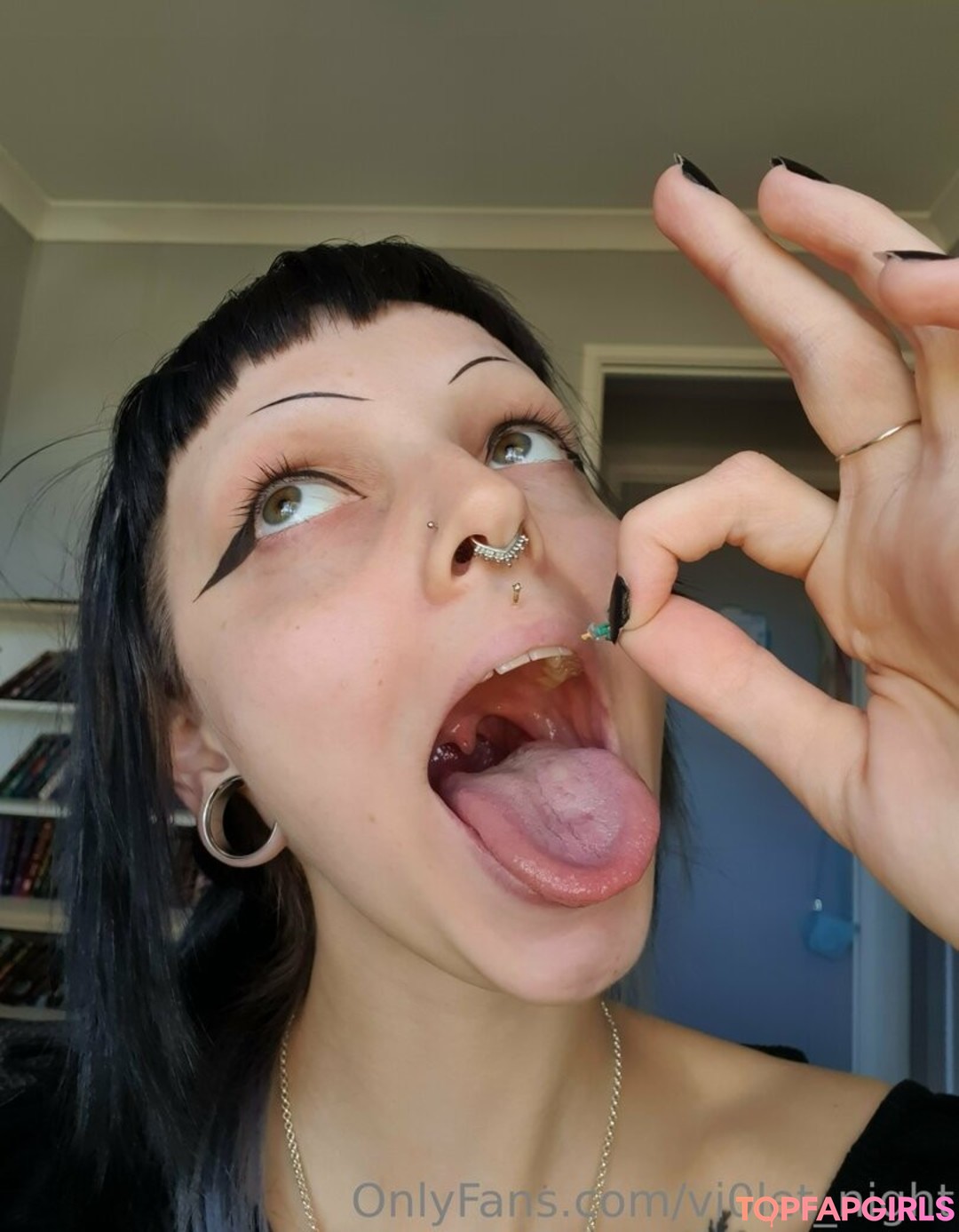 braces onlyfans best pic