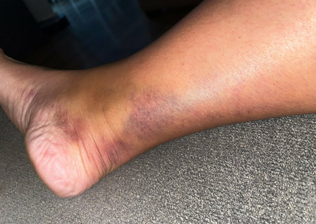 indian milf onlyfans hot nude pic