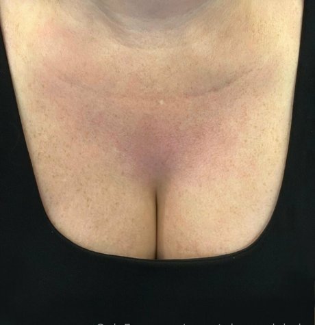 secretpineapplebabe best star pictures