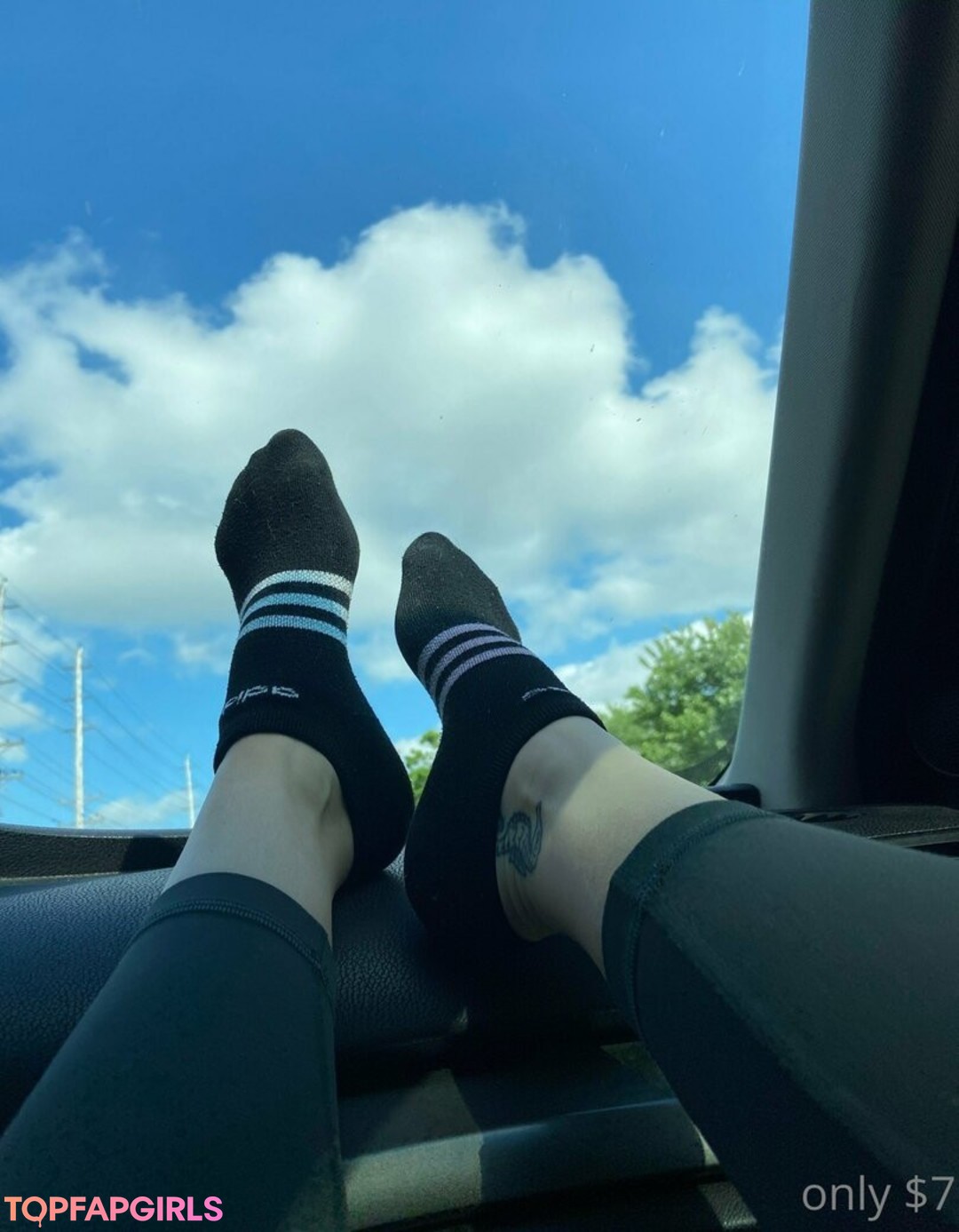 braces onlyfans hot porn img