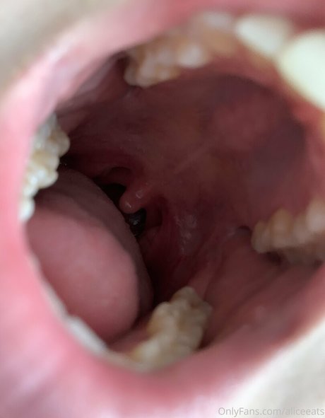 aliceeats model beautiful archive