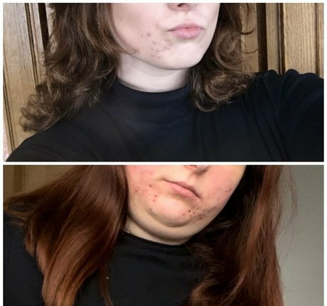 fatmerida star nude images