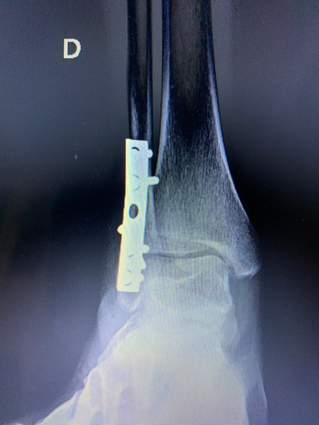 OxfordGold onlyfans leaks naked