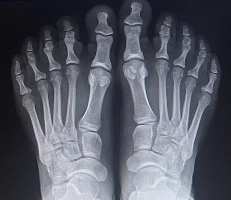 BBfeet only fans naked