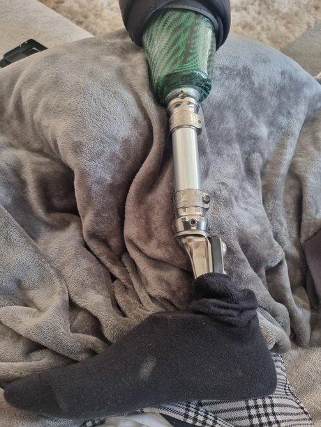 Stumpy only fans nude leaks