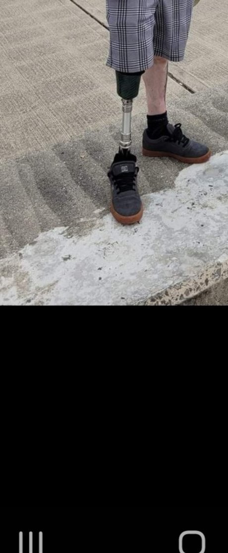 Stumpy onlyfans free porn