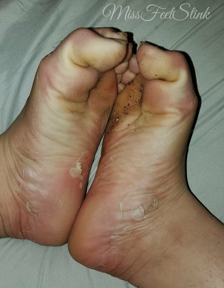 missfeetstinkvip onlyfans leajs