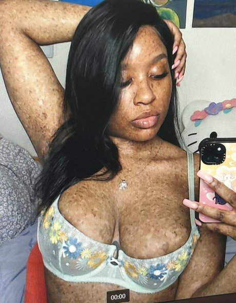 freckledn onlyfans pics leaked