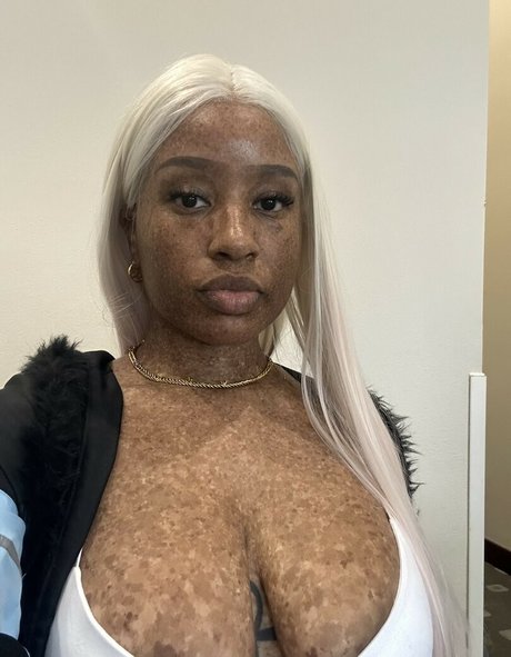 freckledn new onlyfans leaks