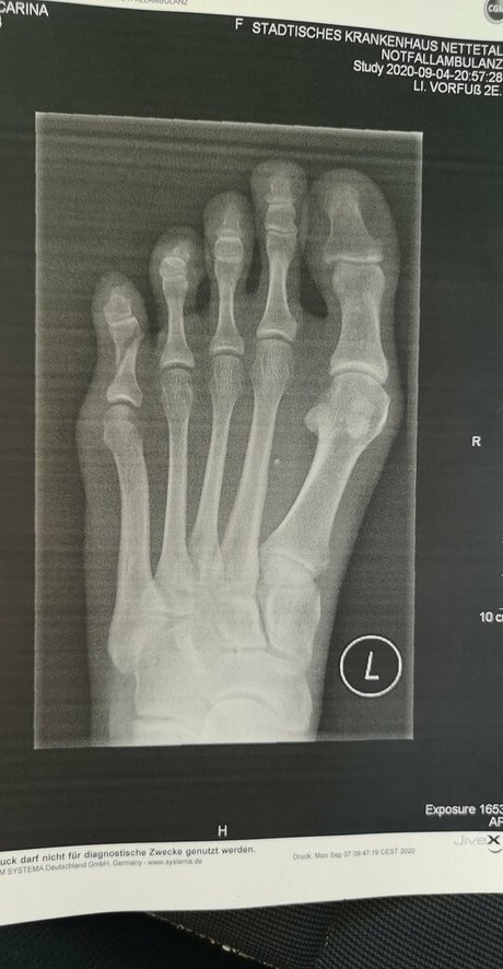 birki heaven leaked onlyfans pictures