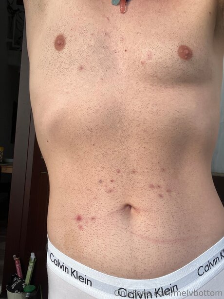 Melvbottom onlyfans keak