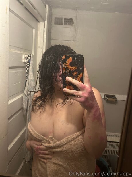 Acidxhappy Profile pic