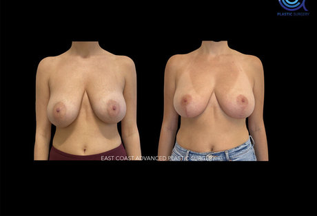 bunny free onlyfans pornographic portrayal