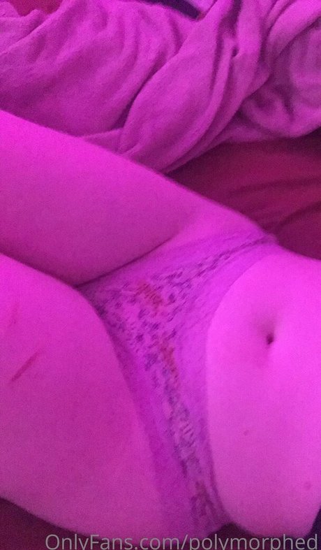 Polymorphed onlyfans leak ass