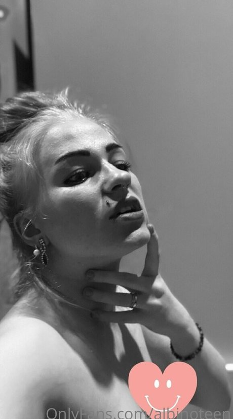 albinoteen onlyfans leaka