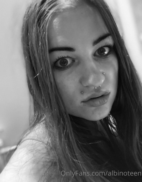 albinoteen onlyfans naked leak