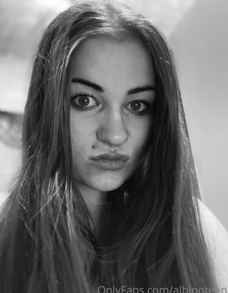 albinoteen onlyfans porn leak