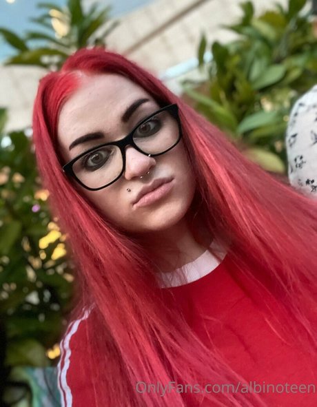 albinoteen onlyfans naked leak