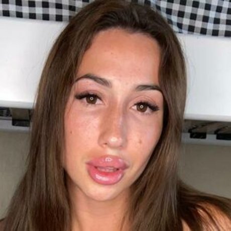 radacatt onlyfans de