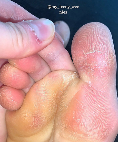 my teeny weenies only fans pics