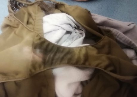 post op shemale onlyfans best img