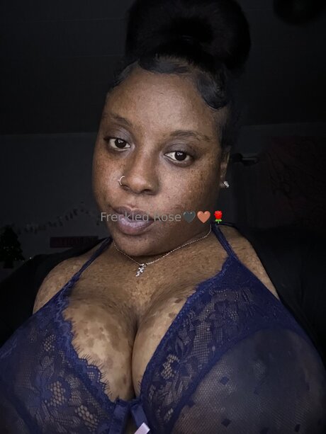 Freckledfantasy5 star hot gallery