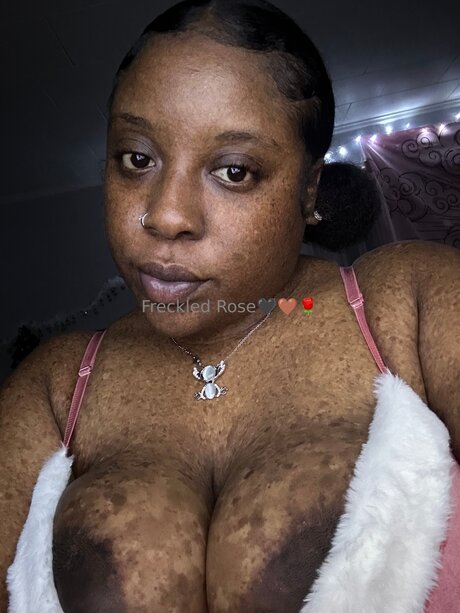 Freckledfantasy5 Best Profile Photo