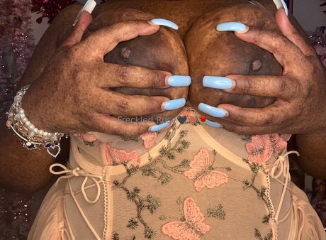 post op shemale onlyfans hot archive