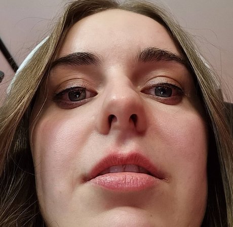 Loserfruit Profile Pic