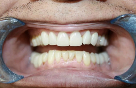 ToothFetish Doc hd star img