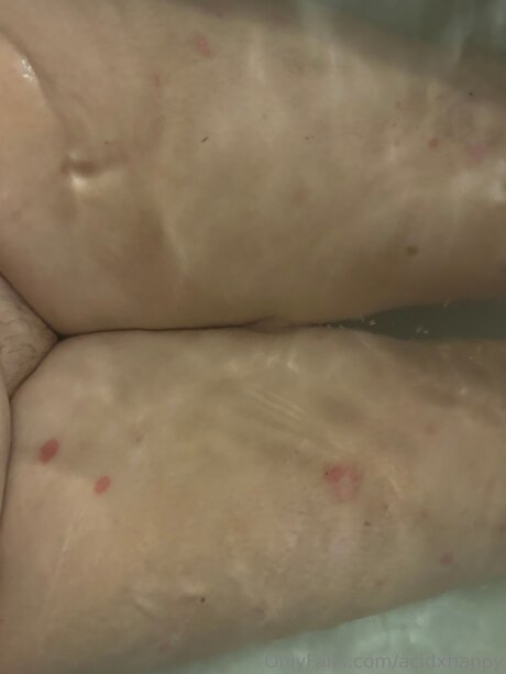 Acidxhappy xxx star pic