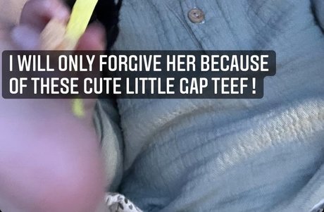 amputee onlyfans free porn galleries