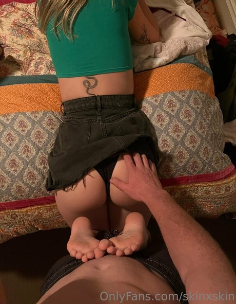 skinxskin model photo