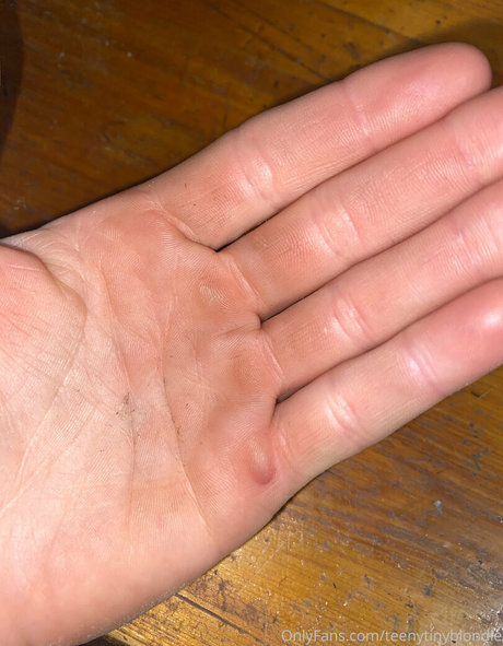 post op shemale onlyfans free picture