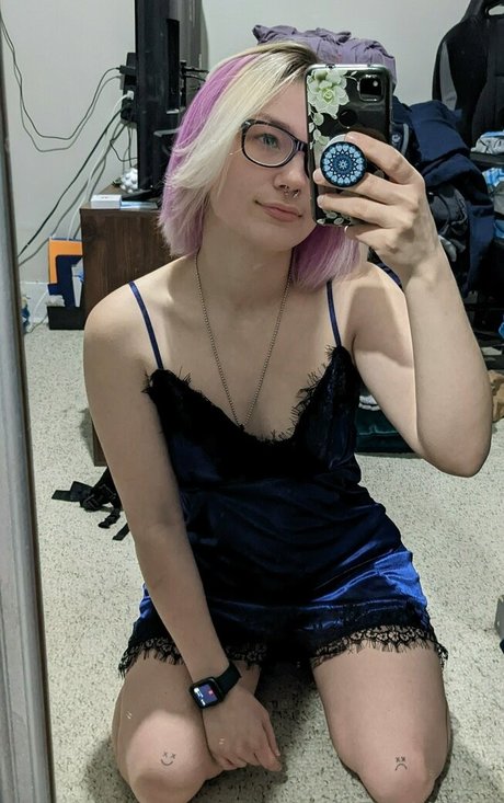 reckitrexi star top photo